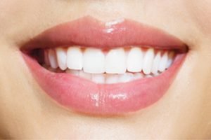 dientes perfectos después de dentista